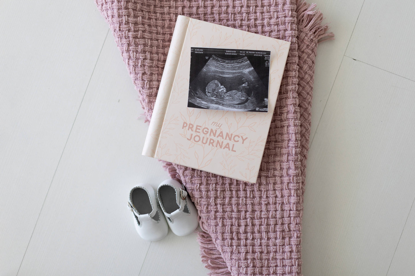 My Pregnancy Keepsake Journal