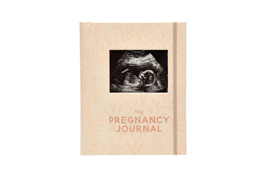 My Pregnancy Keepsake Journal